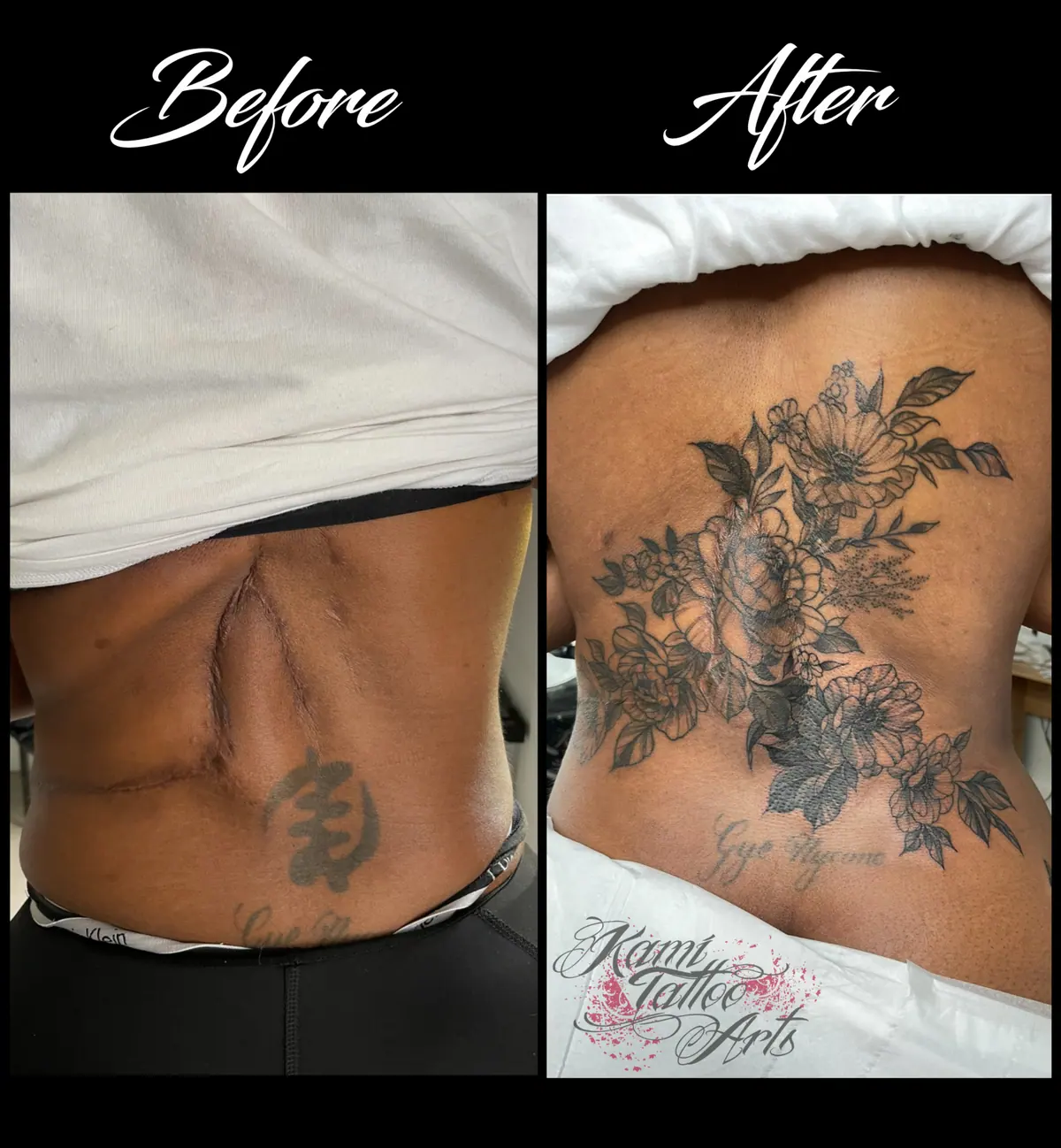 Scars Tattoo Coverup Flowers Fineline Floral Leaves Peonies Roses