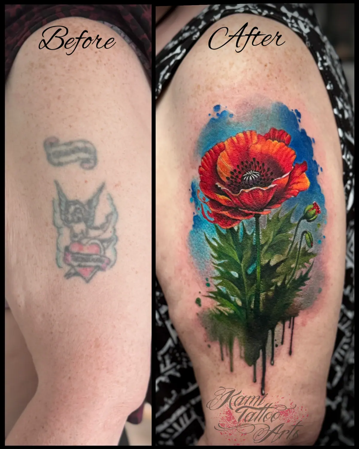 Realism Poppy Coverup Tattoo Watercolour Cover Colour